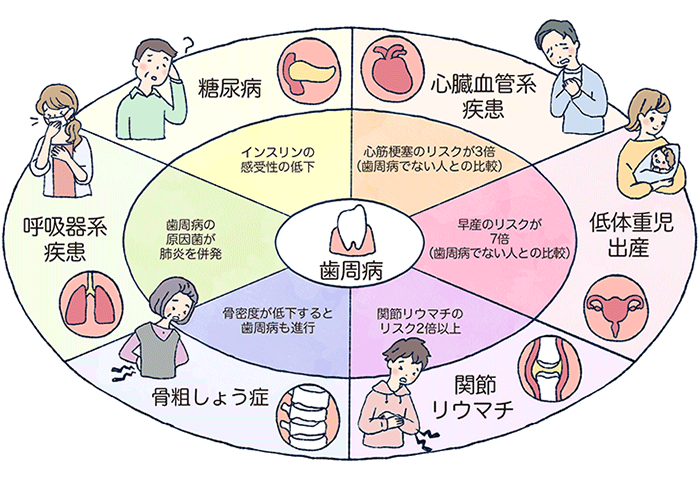 歯周病とさまざまな病気の関係